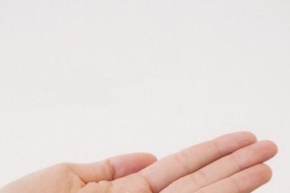 Tanda Keputihan yang Berbahaya