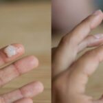 Penyebab Keputihan Menggumpal yang Harus Diketahui