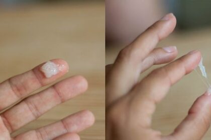 Penyebab Keputihan Menggumpal yang Harus Diketahui