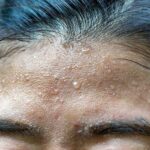 Keluar Keringat Dingin Tanda Penyakit Apa?
