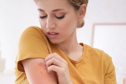 5 Kebiasaan Pemicu Timbulnya Jamur Kulit