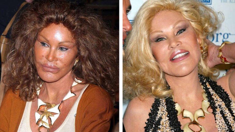 Kisah Jocelyn Wildenstein, Sosialita Kaya Raya yang Jatuh Miskin