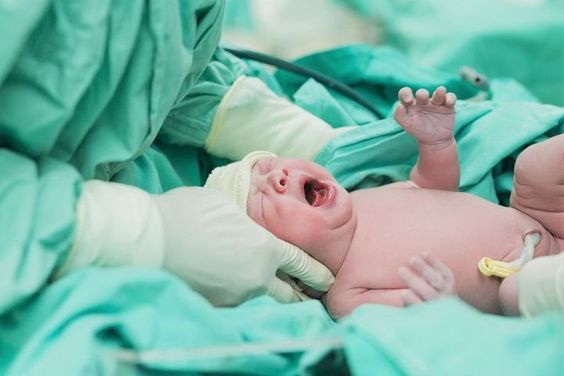 Mengenal Apgar Score, Metode Menilai Kondisi Bayi Baru Lahir