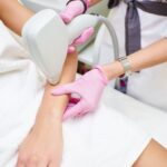 9 Manfaat Laser Hair Removal dan Prosedurnya