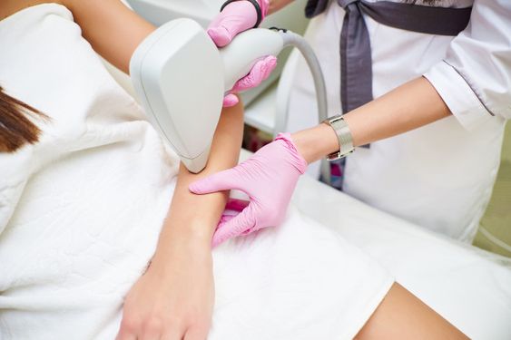 9 Manfaat Laser Hair Removal dan Prosedurnya