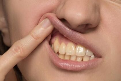 6 Cara Memutihkan Gigi Secara Alami, Gak Khawatir Saat Ngopi!
