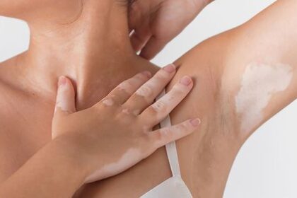 3 Cara Menghilangkan Bulu Ketiak Tanpa Rasa Sakit