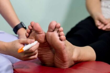 5 Penyakit Langka di Dunia yang Jarang Orang Ketahui