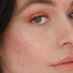 Rekomendasi Moisturizer Gel untuk Kulit Berminyak, Bikin Adem!