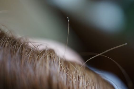 5 Cara Mengatasi Rambut Bercabang, Bisa Coba di Rumah!