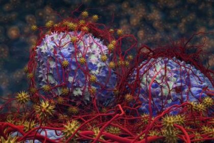 Mengenal Gejala Teratoma, Tumor Langka Berisi Organ