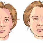 Terlalu Lama Terpapar Kipas Angin Timbulkan Gejala Bell's Palsy?