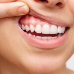 5 Kebiasaan Kecil yang Justru Dapat Merusak Gigimu!