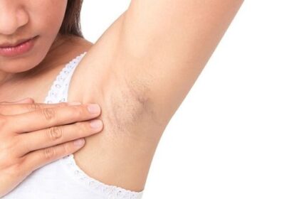 5 Bahan Rumahan untuk Mencerahkan Ketiak Gelap