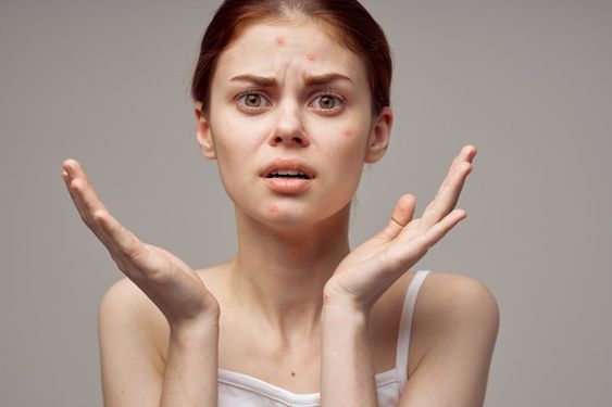 5 Kesalahan Pemilik Kulit Berminyak yang Masih Sering Dilakukan