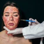 Bahaya yang Mengintai di Balik Vampire Facial