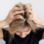 Cara Hilangkan Masalah Ketombe Kering pada Rambut