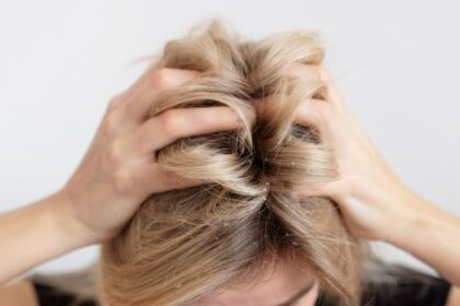 Cara Hilangkan Masalah Ketombe Kering pada Rambut