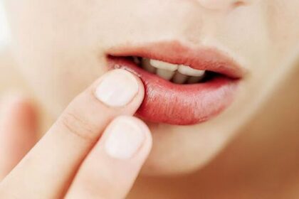 6 Langkah Sederhana Merawat Bibir Pecah-Pecah
