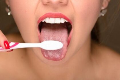 Perbedaan Ciri Lidah Sehat dan Terinfeksi HIV, Waspadai!