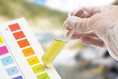 Kenali Warna Air Kencing Sehat sebagai Penanda Kondisi Tubuh