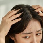 5 Kebiasaan Penyebab Gatal pada Rambut, Jangan Sepele!