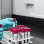 Fakta Virus Mematikan West Nile yang Serang Israel