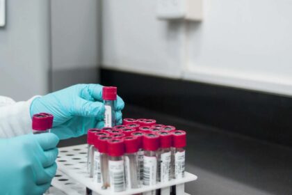 Fakta Virus Mematikan West Nile yang Serang Israel